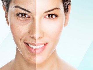 Zadbaj o skórę po intensywnym korzystaniu z uroków lata z kliniką Vesuna.