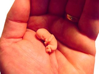 Aborcja i jej skutki.